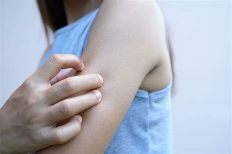 Asian woman has itching on her arms. 34851964 Stock Photo at Vecteezy