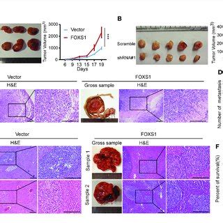 FOXS1 Promotes Tumor Growth And Metastasis In Vivo A B An In Vivo