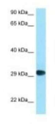 CD58 LFA 3 Antibody NBP1 98401 By Novus Part Of Bio Techne