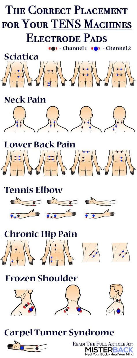 8 Best Tens Images Tens Unit Placement Tens Electrodes Tens