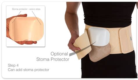 Stoma Guard