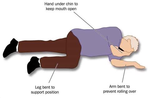 First Aid For Heart Stroke