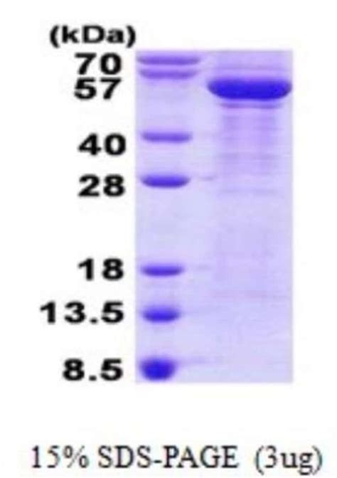 Novus Biologicals Recombinant Human Beta Iii Tubulin His Protein Mg