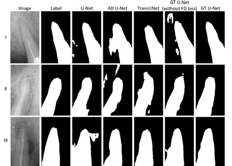 Representative Segmentation Results Achieved By Different Methods Download Scientific Diagram