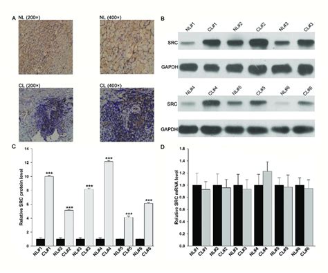 Expression Levels Of The Src Protein And Mrna In Lung Cancer Tissues