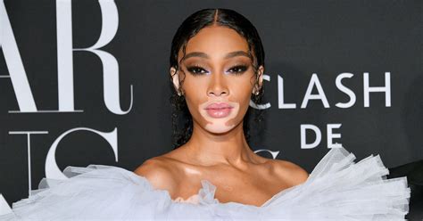 Winnie Harlow Net Worth 2024: What Is The Model Worth?