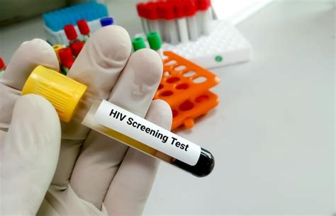 Premium Photo | Hiv screening test to diagnose hiv infection