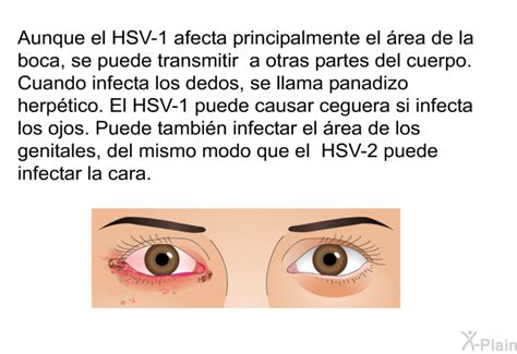 PatEdu Herpes Labial