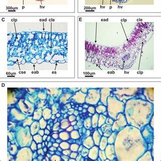 Fotomicrograf As De Secciones Transversales De Hoja A C D L Albus