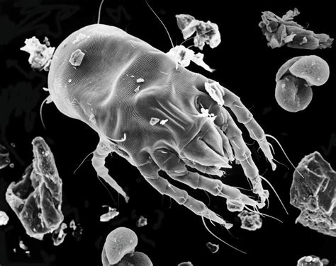 Dust Mite Microscope