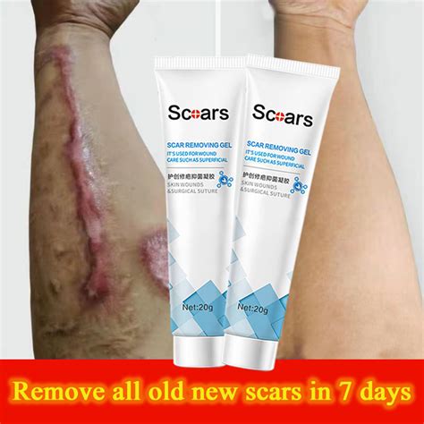 Scar Remover For Old Scar On Leg Scar Gel Original Stretch Mark Remover