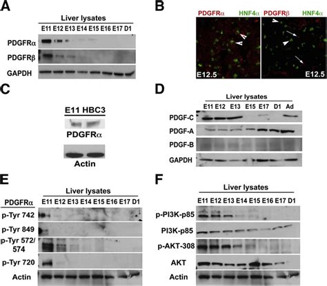 Pdgfra Expression And Activation In Early Liver Development A A