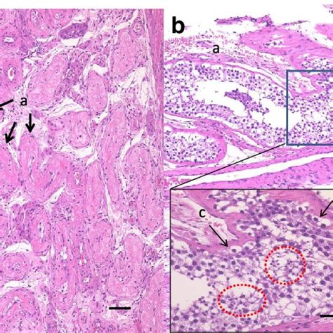 Histopathological Findings Using Hematoxylin And Eosin Stain A