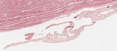 Interventricular Septum Histology