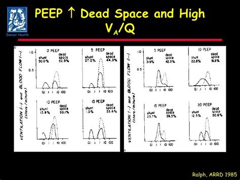 Physiology Of Peep In Ards