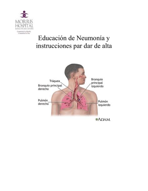 Educación de Neumonía y instrucciones par dar de