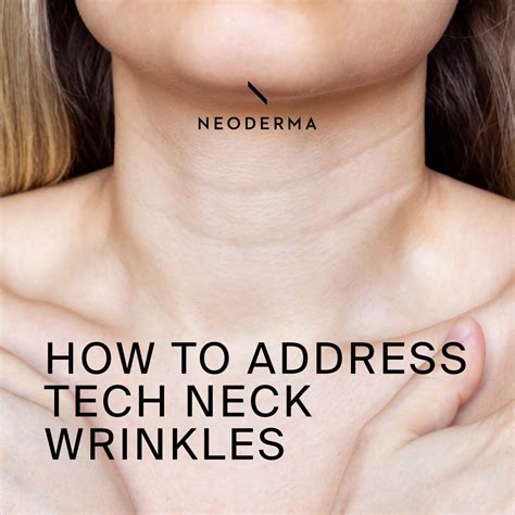 Tech Neck Wrinkles Lines Dark Lines On Tech Neck Wrinkles Treatment