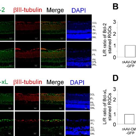 Levels Of P Akt In The Retinas Of Rats With Elevated Iop Overexpressing