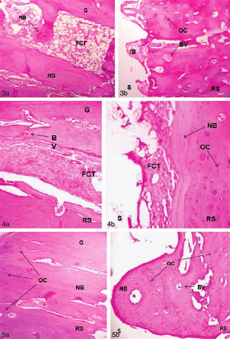 Hematoxylin And Eosin Stained 3 Week Histological Analysis Of Bone