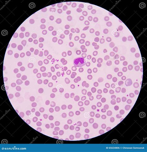 Blood Smear Cartoon Vector | CartoonDealer.com #45241541