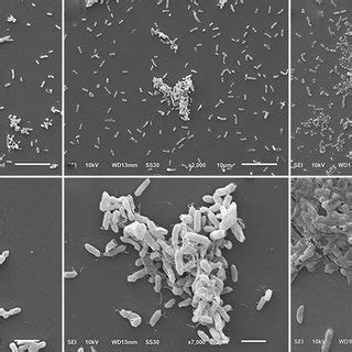 Representative Scanning Electron Micrographs Of Biofilm Formed By