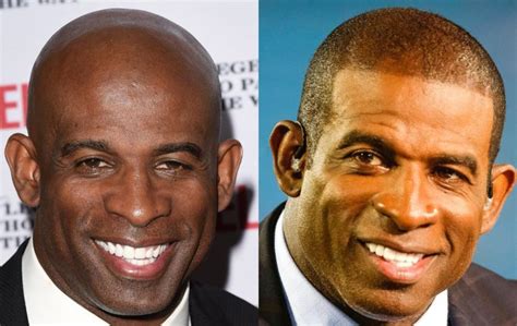 Deion Sanders Hair Transplant - Cosmeticium
