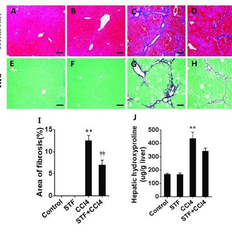 Effects Of Stf 083010 Stf On Ccl 4 Induced Liver Injury And Liver