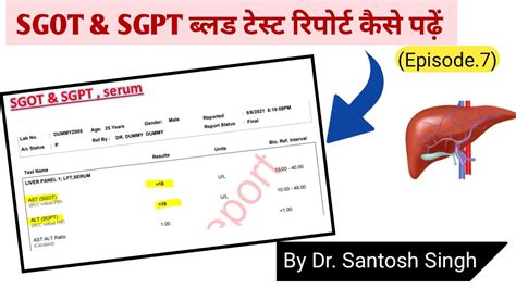 How To Read Sgpt Sgot Test Report Liver Function Test Dr Santosh