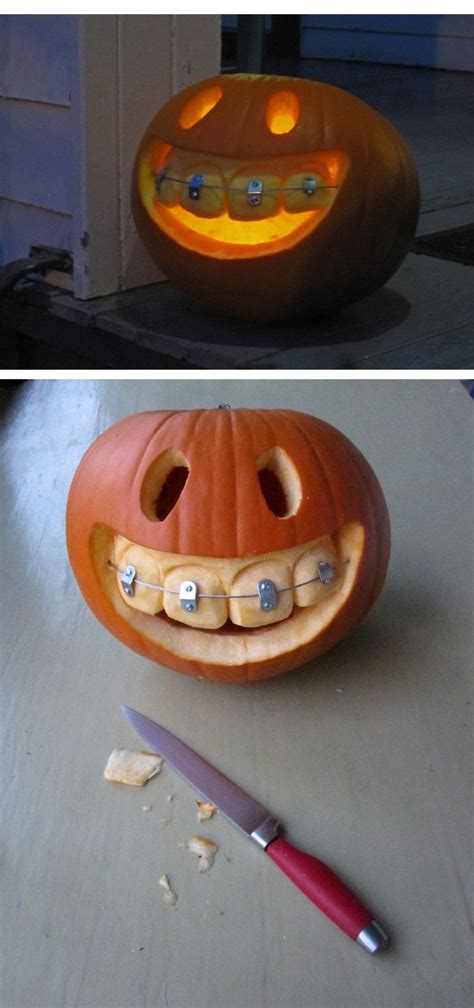 Pumpkin With Braces Pumpkin Carving Halloween Pumpkins Halloween Diy