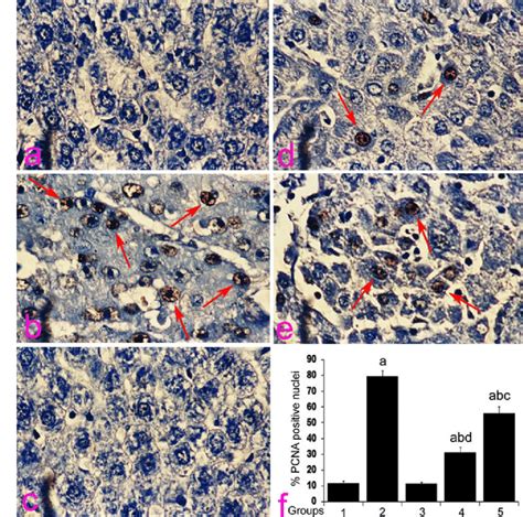 Representative Immunohistochemical Staining Of PCNA In The Liver Of