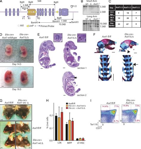 Deletion Of Asxl1 Results In Myelodysplasia And Severe Developmental