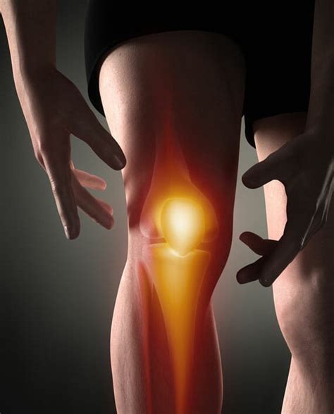 Protective-Muscle-Guarding-of-the-Knee | X10 Therapy