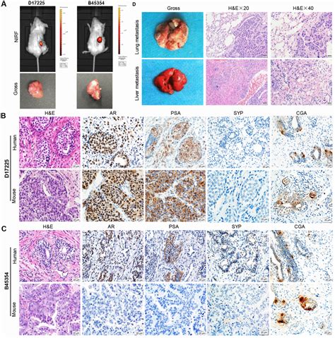 Establishment And Characterization Of Patient Derived Xenografts For