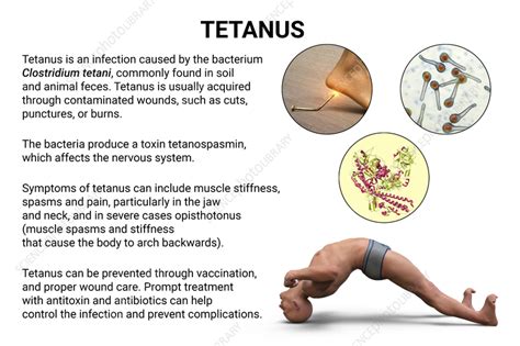 Tetanus Bacteria Life Cycle