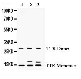 Anti TTR Transthyretin Antibody Rabbit Anti Rat Polyclonal LSBio