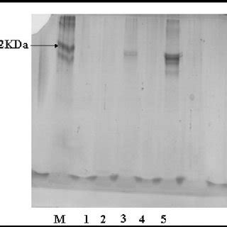 SDS PAGE Of Gel Filtration Lane M Shows BSA Lanes 1 2 3 4 And 5