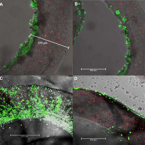 Confocal Imaging Of HepG2 And SK HEP 1 Cells Stained With CTred And