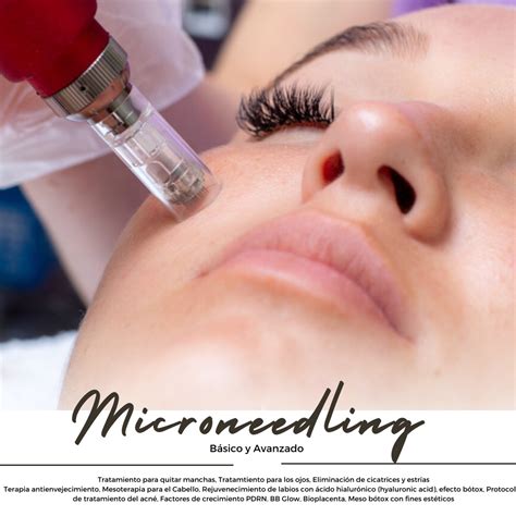 Microneedling B Sico Y Avanzado Tratamientos Con Meso Infusi N