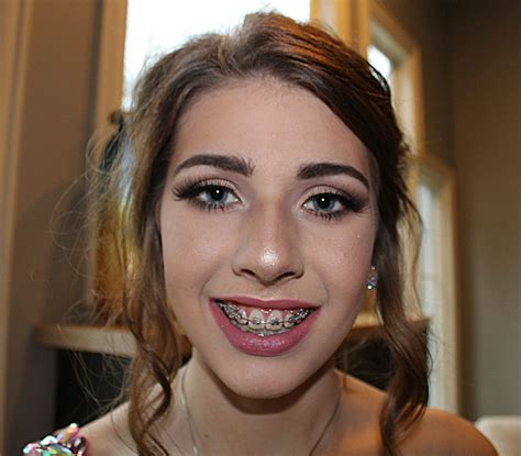 Pin By Steve Mc On Braces Faces Cute Braces Braces Girls