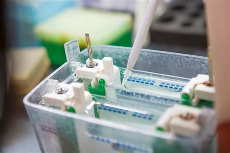 Premium Photo Western Blot Analysis Or Protein Analysis