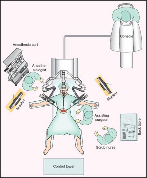 Anesthesia For Laparoscopic And Robotic Surgeries Anesthesia Key