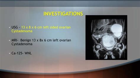 Laparoscopy For Ovarian Tumours In In Pregnancy Ppt