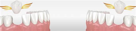 Заживление десны после удаления зуба: сколько длится, что делать, как ...
