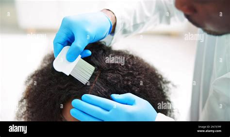 Scalp Treatment From Psoriasis And Dandruff Dermatologist Doctor Stock