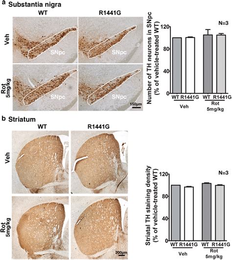 Immunohistochemistry Of Tyrosine Hydroxylase Th In The Substantia