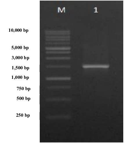 Result of 16S rRNA gene amplification using 27F and 1429R primers (M: 1 ... 