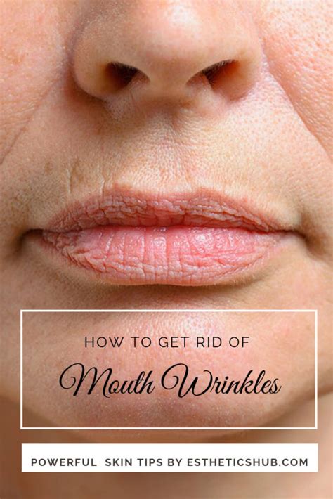 How to Get Rid of Wrinkles Around Your Mouth and Lips Naturally!