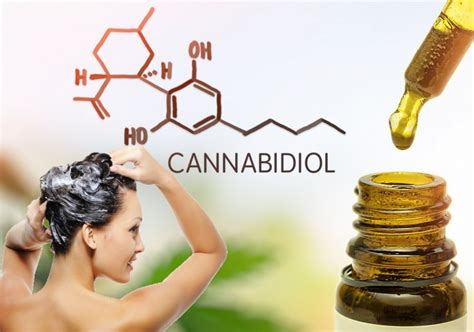 Can Cbd Shampoo Reduce The Severity Of Scalp Inflammation And Dandruff