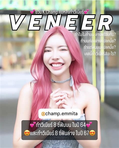 Emmita Hirunapsorn | 🔺 แชร์ประสบการณ์การทำ วีเนียร์ของแชมป์เอง 😁😆 ใน
