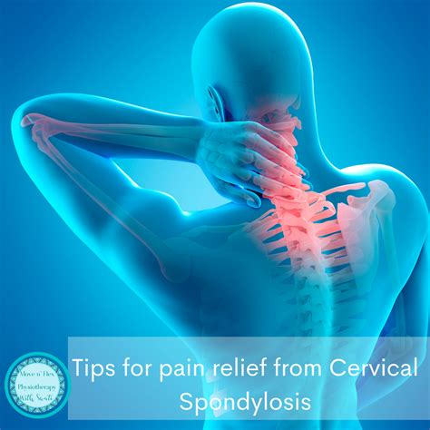 Easy tips for pain relief from Cervical Spondylosis (neck pain) | Swati ...